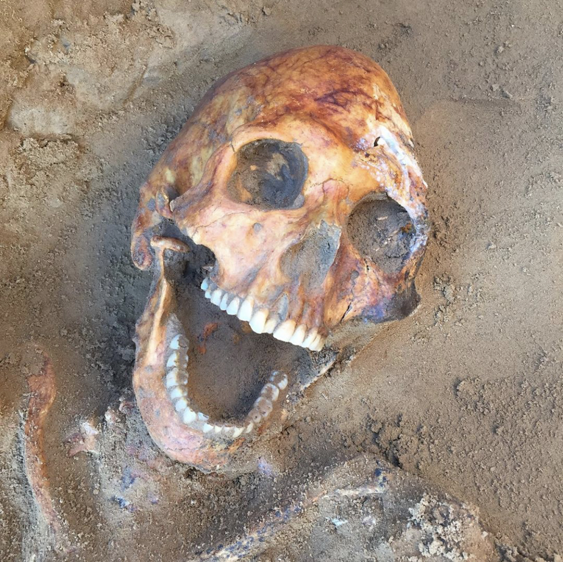 «Инопланетный» череп и детское захоронение, которому около 4 тысяч лет, нашли под Астраханью